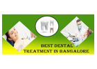 Best Dental Treatment in Bangalore