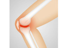 How Much Does Knee Replacement Surgery Cost in Delhi